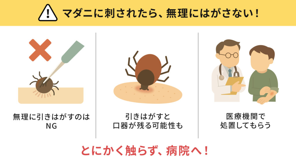 マダニに刺されたら無理にはがさない